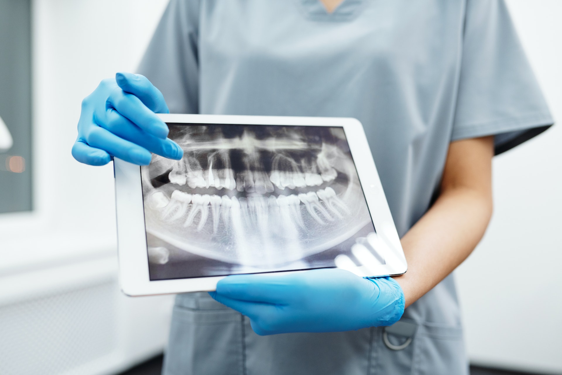 In care situatii se poate opta pentru extractii dentare? Iata ce spun specialistii din domeniu!